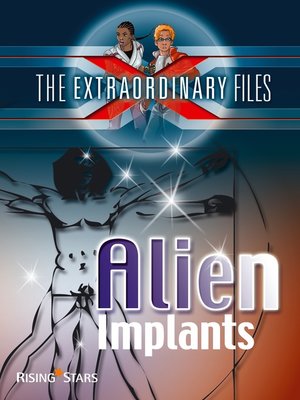 cover image of Alien Implants